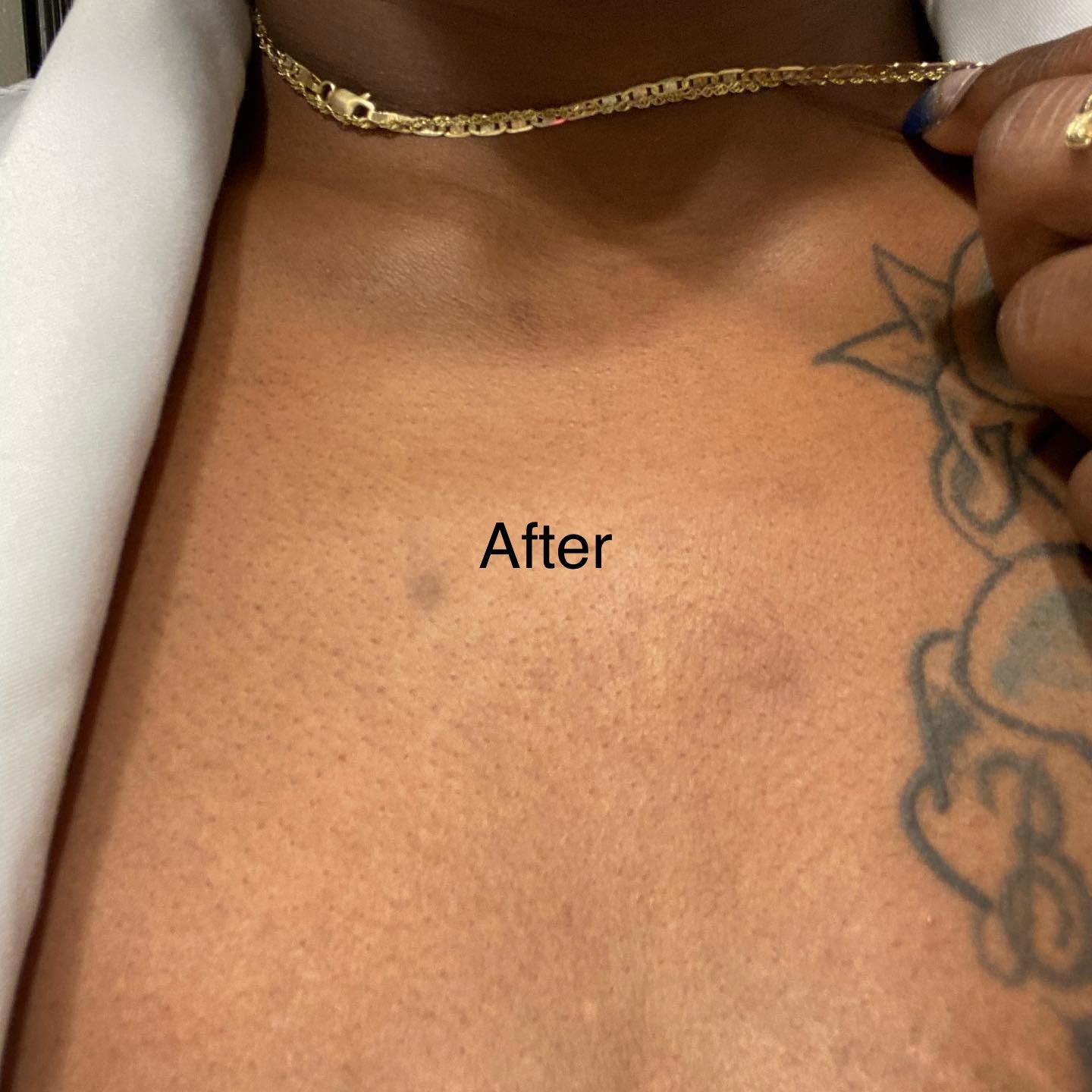 Scar Serum